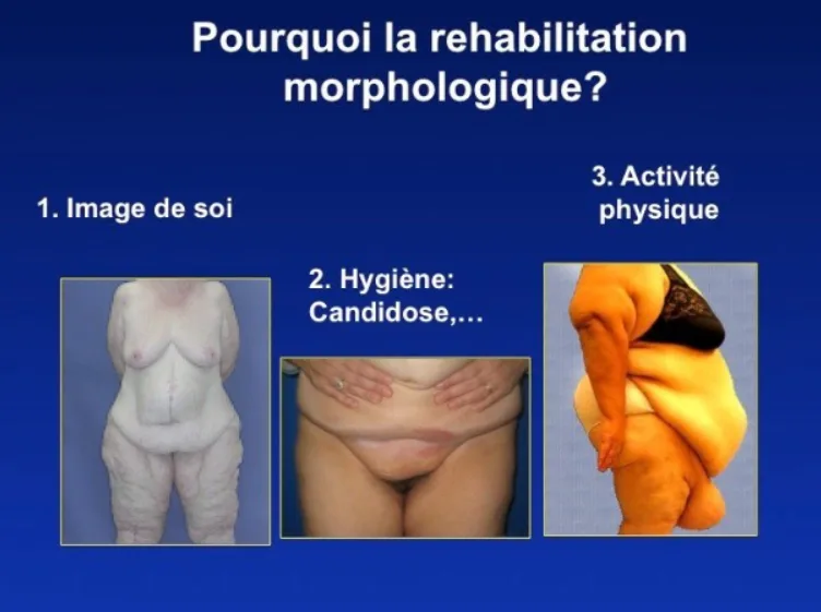 Image retirée.