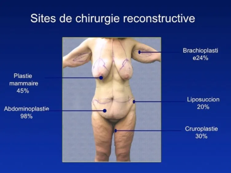 Image retirée.
