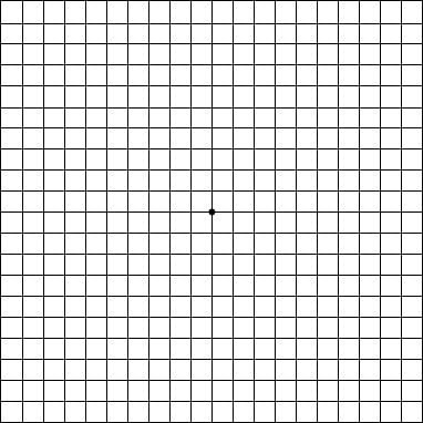 grille d'amsler