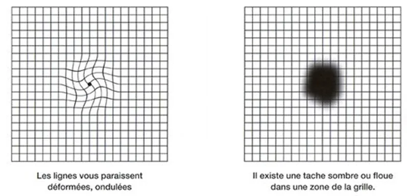 Image retirée.