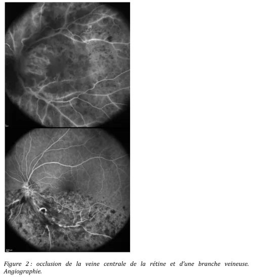 Image retirée.