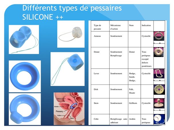 diffèrent type de pessaire