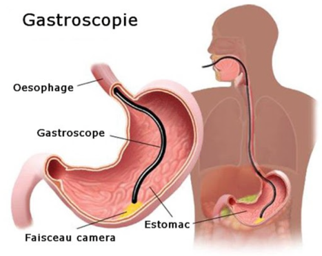 Endoscopie