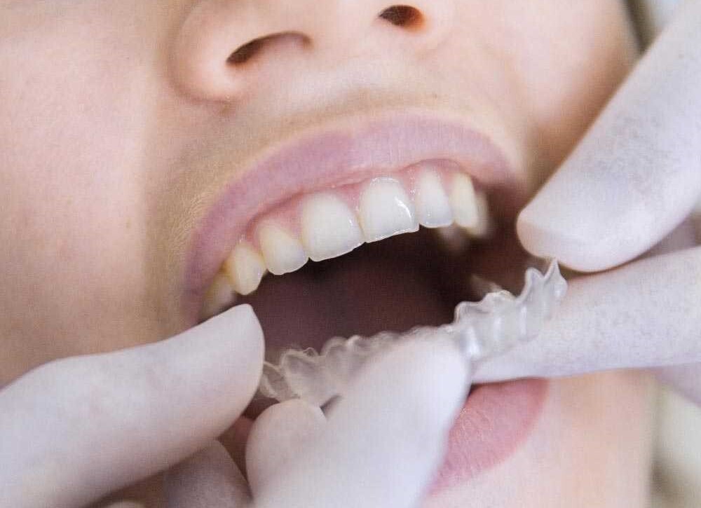 orthodontie
