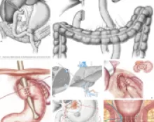 Les pathologies traitées