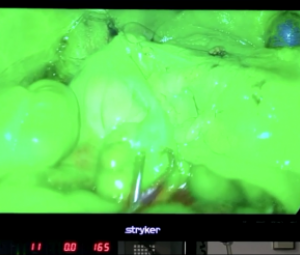 Colonne chirurgicale coelioscopique avec fluorescence