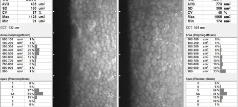 microscopiespeculaire