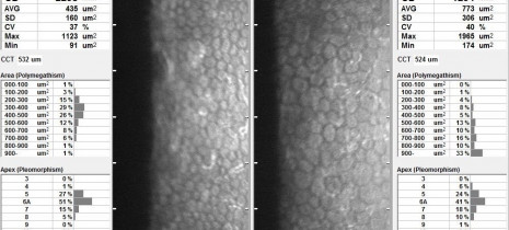 microscopiespeculaire