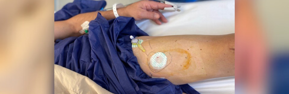 Prothèse de genou : des cathéters à domicile pour une continuité des soins